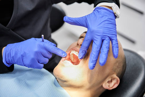 Best Root Canal Emergency Dentist  in Tuskegee, AL